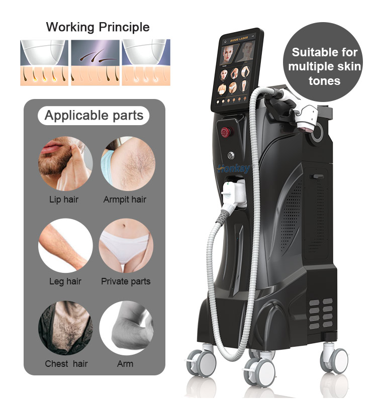 laser hair removal machine distributors