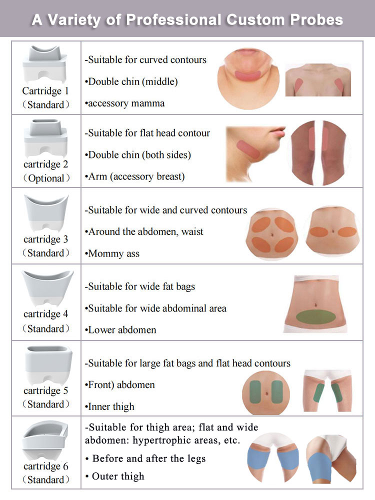 máquina de adelgazamiento de crioterapia