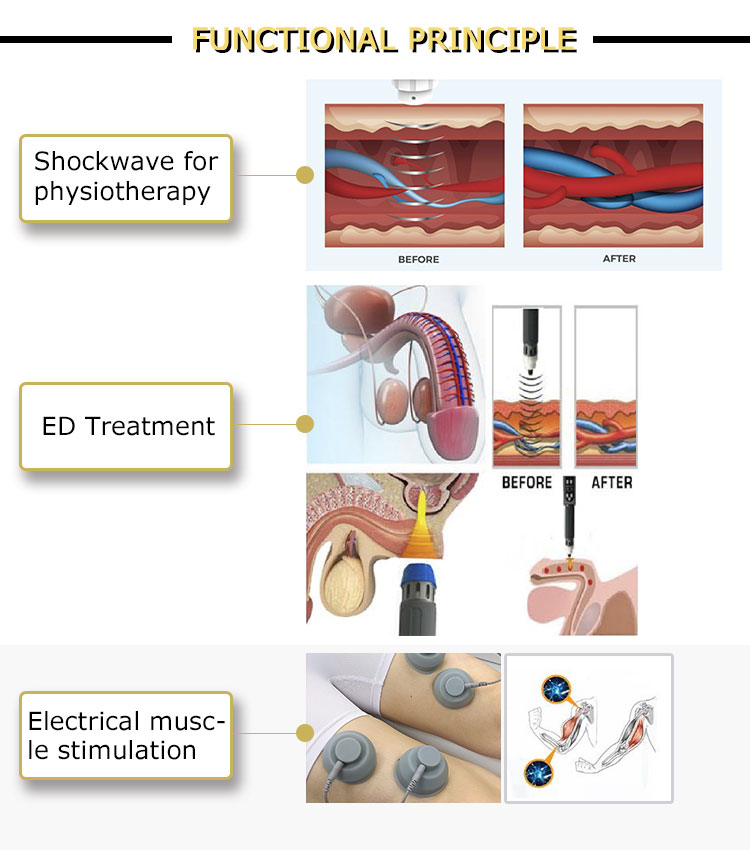 gainswave pneumatic shock wave therapy for ed