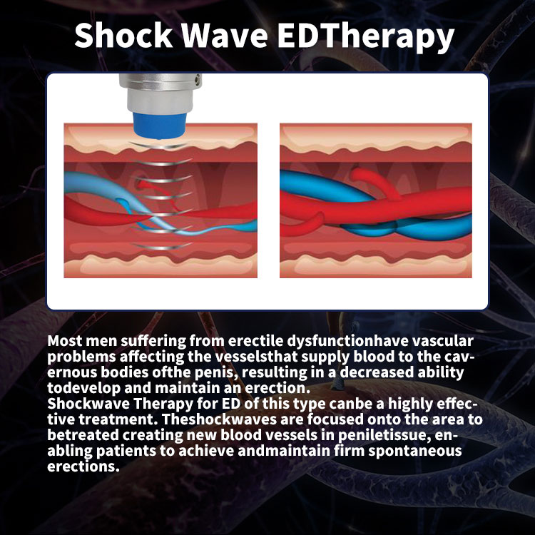 shock wave massager