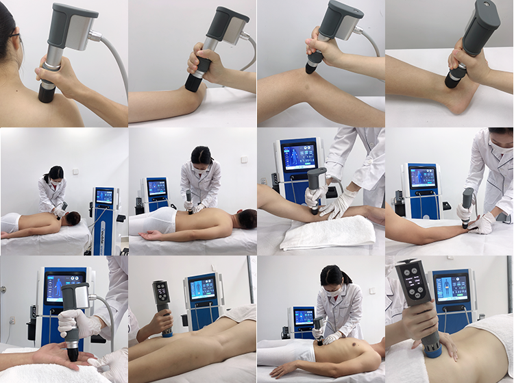 focus shockwave therapy
