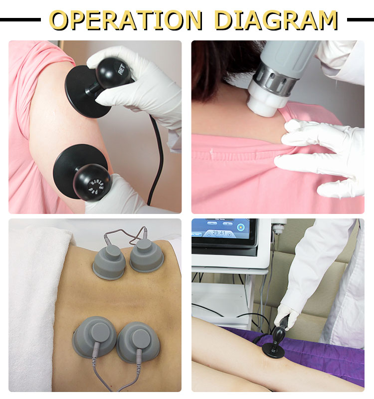 soft wave therapy machine for sale