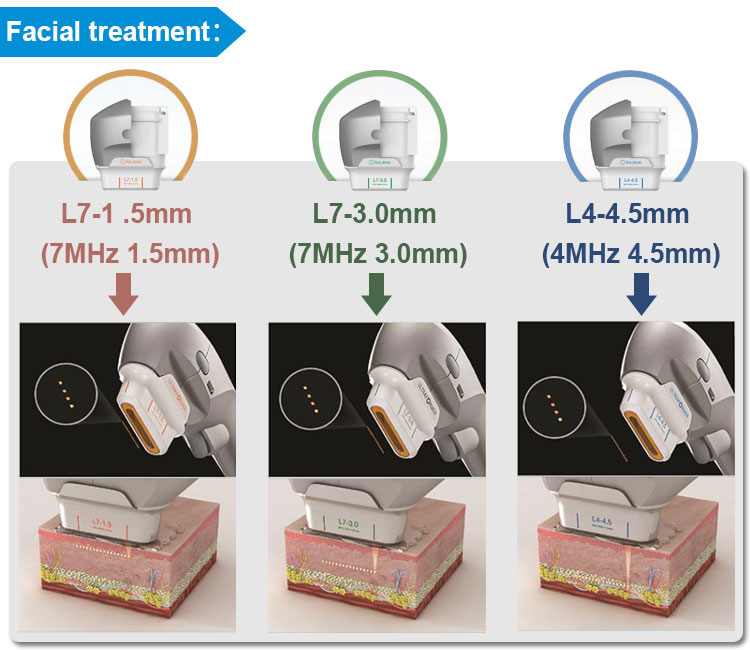 7D Hifu Face and Body Machine