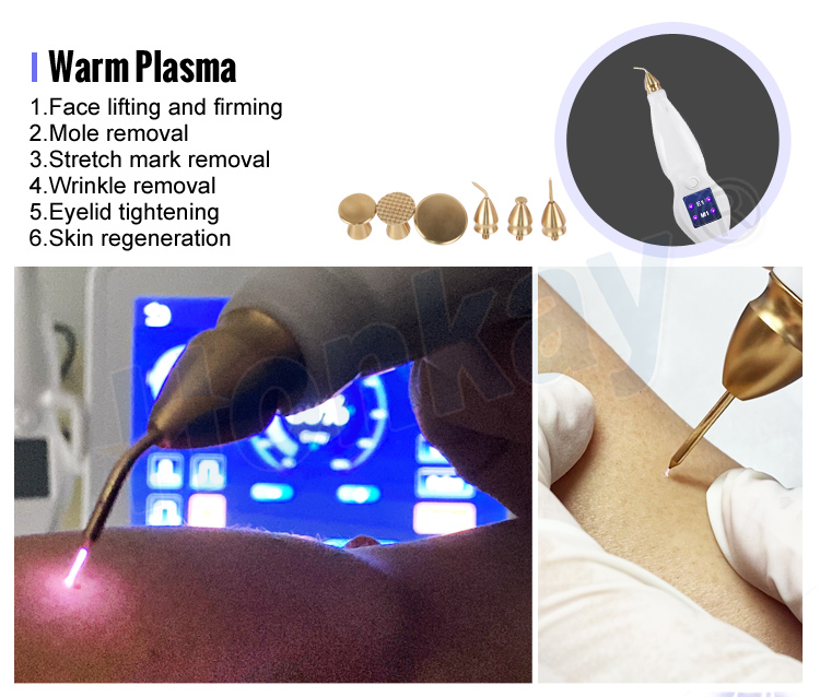 cold plasma pen