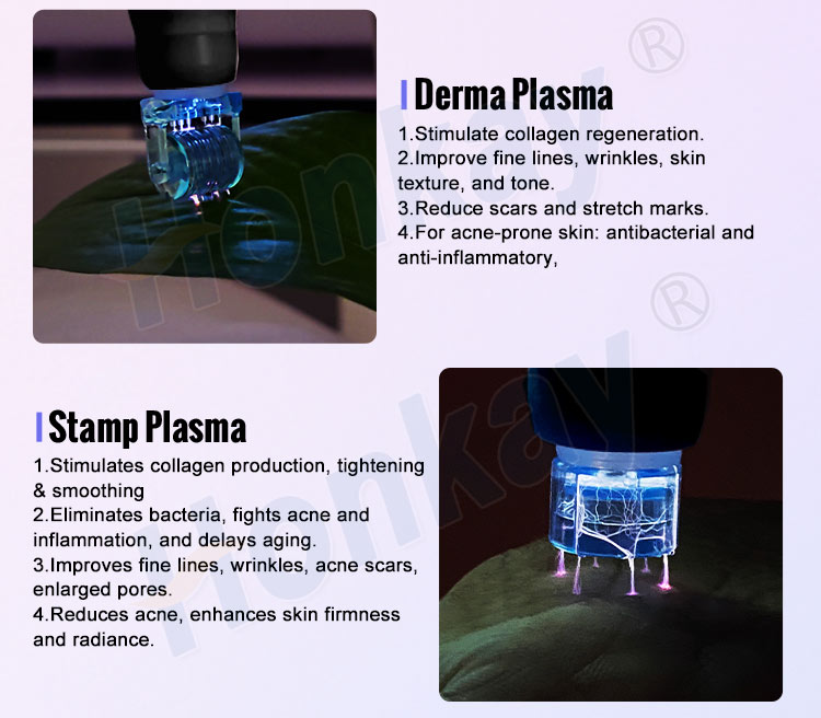 fibroblast plasma lift machine