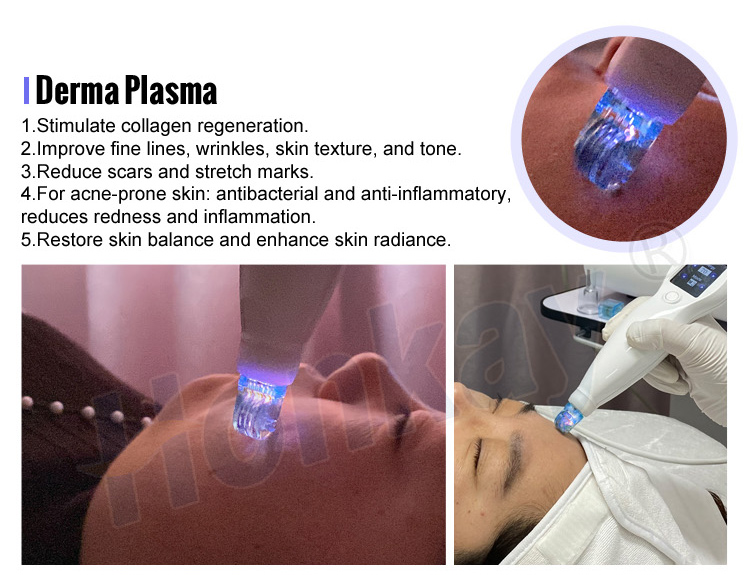 cold plasma device