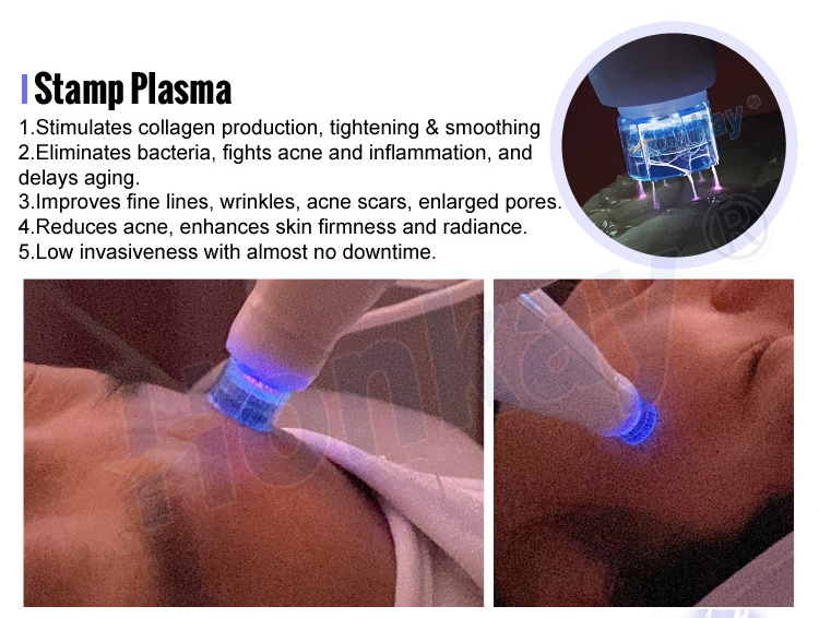 cold plasma device