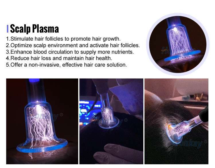 cold plasma beauty device