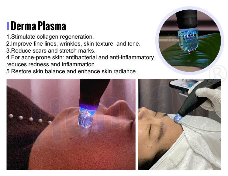 cold plasma beauty device