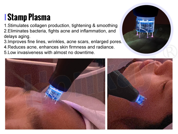 cold plasma beauty device