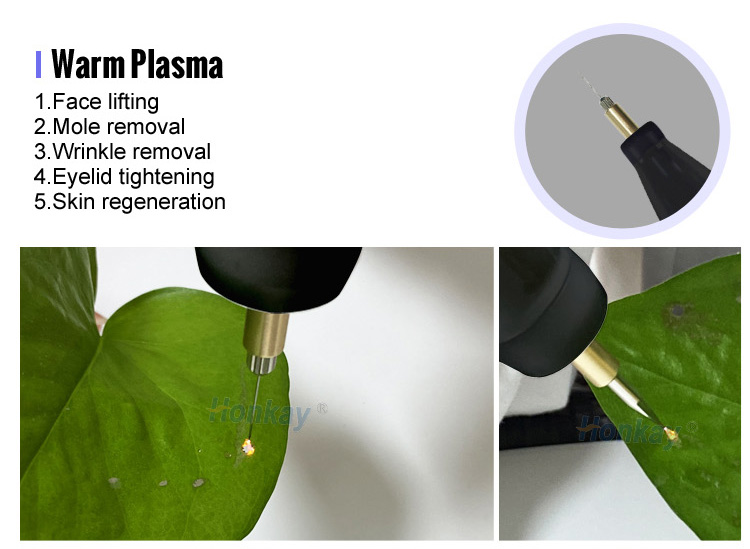 cold plasma beauty device