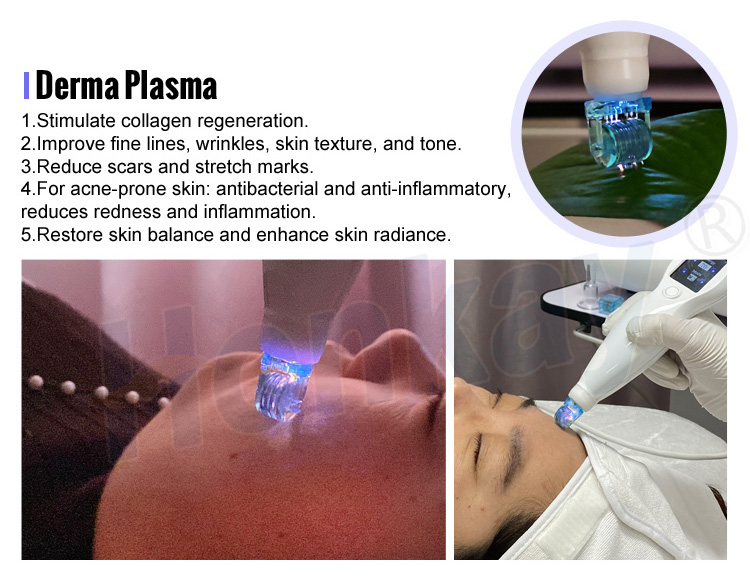 cold plasma device price