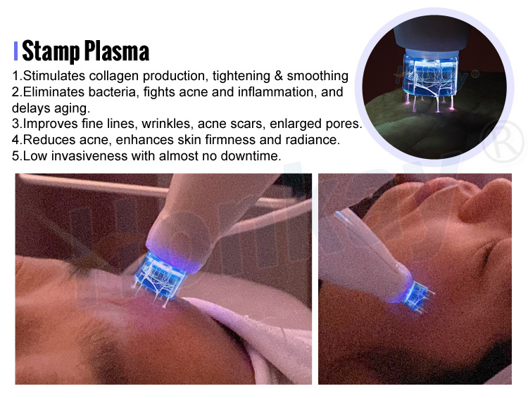 cold plasma device price