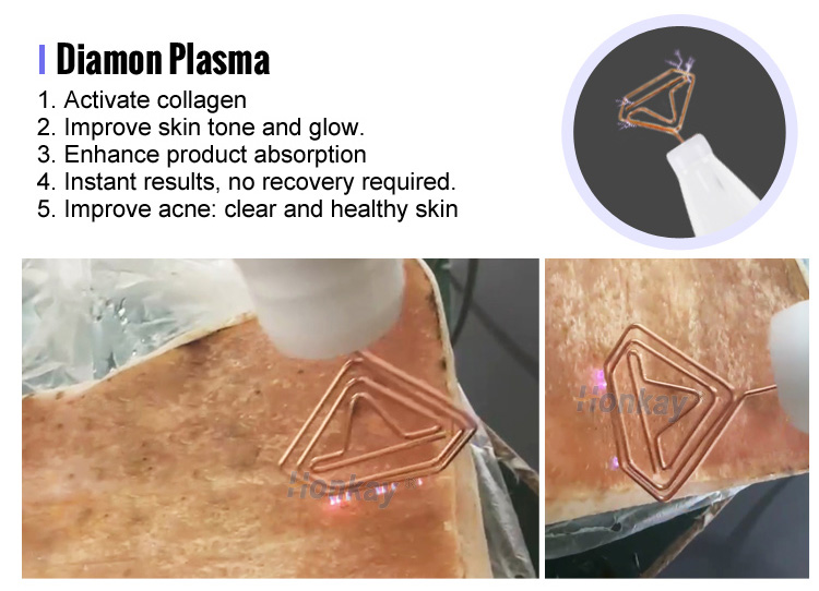 cold plasma device price